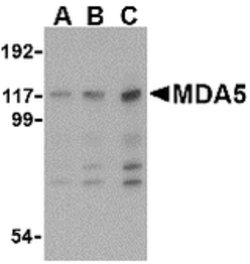 Invitrogen MDA5 Polyclonal Antibody 100 &mu;g | Buy Online | Invitrogen&trade; | Fisher Scientific