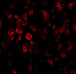 Invitrogen SCO2 Polyclonal Antibody 100 &mu;g | Buy Online | Invitrogen&trade; | Fisher Scientific