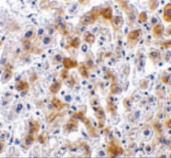 Invitrogen SCO2 Polyclonal Antibody 100 &mu;g | Buy Online | Invitrogen&trade; | Fisher Scientific