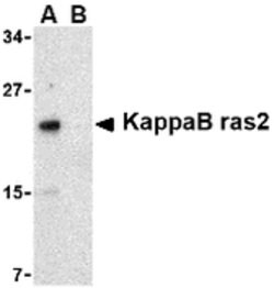Invitrogen KappaB ras2 Polyclonal Antibody 100 &mu;g; Unconjugated:Antibodies,