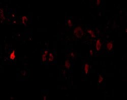 Invitrogen CD273 (B7-DC) Polyclonal Antibody 100 &mu;g; Unconjugated:Antibodies,