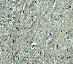 Invitrogen CD273 (B7-DC) Polyclonal Antibody 100 &mu;g; Unconjugated:Antibodies,