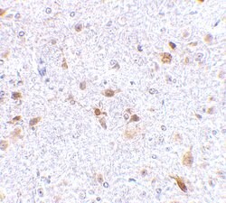 Invitrogen CD273 (B7-DC) Polyclonal Antibody 100 &mu;g; Unconjugated:Antibodies,