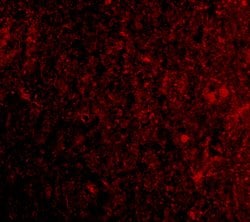 Invitrogen PD-1 Polyclonal Antibody 100 μg; Unconjugated:Antibodies,