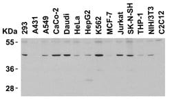 Invitrogen PD-1 Polyclonal Antibody 100 μg; Unconjugated:Antibodies,