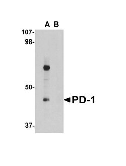 Invitrogen PD-1 Polyclonal Antibody 100 μg; Unconjugated:Antibodies,