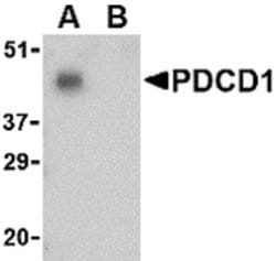Invitrogen PD-1 Polyclonal Antibody 100 μg; Unconjugated:Antibodies,