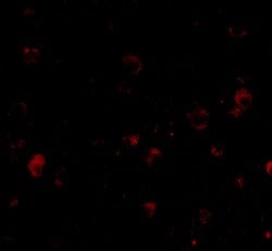 BRSK1 Polyclonal Antibody, Invitrogen 100 &mu;g; Unconjugated:Antibodies,