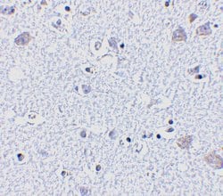 BRSK1 Polyclonal Antibody, Invitrogen 100 &mu;g; Unconjugated:Antibodies,
