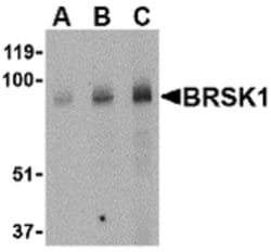 BRSK1 Polyclonal Antibody, Invitrogen 100 &mu;g; Unconjugated:Antibodies,
