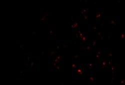 Invitrogen TEP1 Polyclonal Antibody 100 &mu;g; Unconjugated:Antibodies,