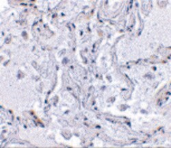 Invitrogen TEP1 Polyclonal Antibody 100 &mu;g; Unconjugated:Antibodies,