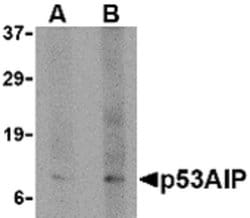 Invitrogen p53AIP1 Polyclonal Antibody 100 &mu;g; Unconjugated:Antibodies,