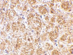 Invitrogen DARC Polyclonal Antibody 100 &mu;g; Unconjugated:Antibodies,