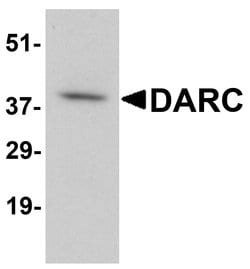 Invitrogen DARC Polyclonal Antibody 100 &mu;g; Unconjugated:Antibodies,