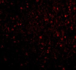 Invitrogen STK29 Polyclonal Antibody 100 &mu;g; Unconjugated:Antibodies,