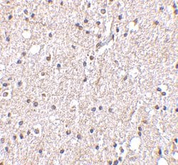 Invitrogen STK29 Polyclonal Antibody 100 &mu;g; Unconjugated:Antibodies,