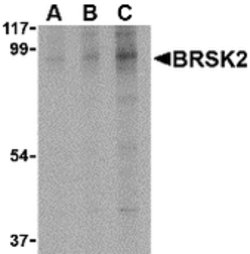 Invitrogen STK29 Polyclonal Antibody 100 &mu;g; Unconjugated:Antibodies,