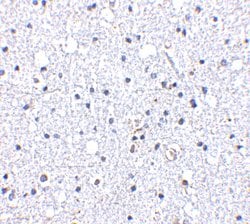 Invitrogen DARC Polyclonal Antibody 100 &mu;g; Unconjugated:Antibodies,