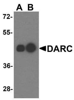 Invitrogen DARC Polyclonal Antibody 100 &mu;g; Unconjugated:Antibodies,