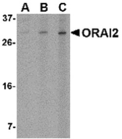 Invitrogen ORAI2 Polyclonal Antibody 100 &mu;g | Buy Online | Invitrogen&trade; | Fisher Scientific