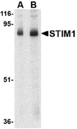 Invitrogen STIM1 Polyclonal Antibody 100 &mu;g; Unconjugated:Antibodies,