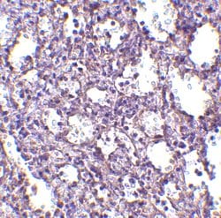 Invitrogen STIM2 Polyclonal Antibody 100 &mu;g; Unconjugated:Antibodies,