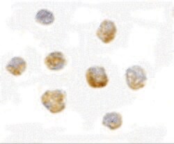 Invitrogen HUWE1 Polyclonal Antibody 100 &mu;g; Unconjugated:Antibodies,
