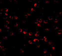 Invitrogen HUWE1 Polyclonal Antibody 100 &mu;g; Unconjugated:Antibodies,