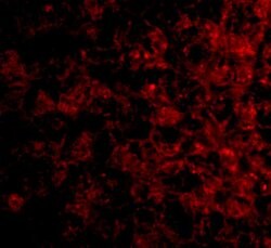 Invitrogen TSLP Receptor Polyclonal Antibody 100 &mu;g; Unconjugated:Antibodies,