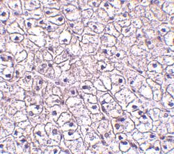 Invitrogen TSLP Receptor Polyclonal Antibody 100 &mu;g; Unconjugated:Antibodies,