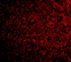Invitrogen TSLP Receptor Polyclonal Antibody 100 &mu;g; Unconjugated:Antibodies,