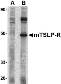 Invitrogen TSLP Receptor Polyclonal Antibody 100 &mu;g; Unconjugated:Antibodies,