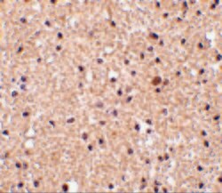 Invitrogen Stathmin 1 Polyclonal Antibody 100 &mu;g; Unconjugated:Antibodies,