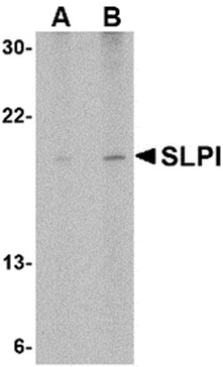 Invitrogen SLPI Polyclonal Antibody 100 &mu;g | Buy Online | Invitrogen&trade; | Fisher Scientific