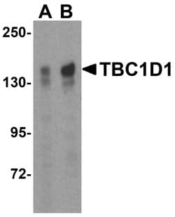 Invitrogen TBC1D1 Polyclonal Antibody 100 &mu;g | Buy Online | Invitrogen&trade; | Fisher Scientific
