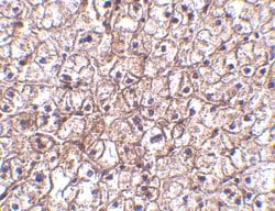 Invitrogen IFN beta Polyclonal Antibody 100 &mu;g | Buy Online | Invitrogen&trade; | Fisher Scientific