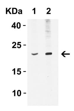 Invitrogen IFN beta Polyclonal Antibody 100 &mu;g | Buy Online | Invitrogen&trade; | Fisher Scientific