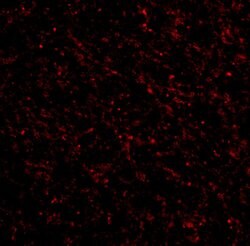 Invitrogen TACR3 Polyclonal Antibody 100 &mu;g | Buy Online | Invitrogen&trade; | Fisher Scientific