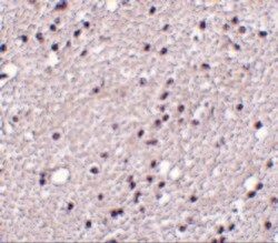 Invitrogen&trade;&nbsp;TACR3 Polyclonal Antibody