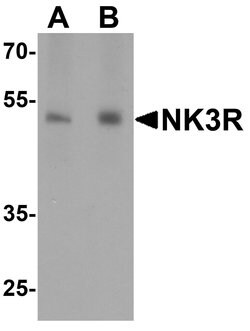 Invitrogen TACR3 Polyclonal Antibody 100 &mu;g | Buy Online | Invitrogen&trade; | Fisher Scientific