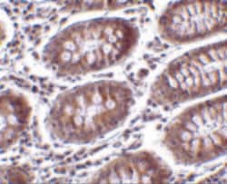 Invitrogen MICA Polyclonal Antibody 100 &mu;g | Buy Online | Invitrogen&trade; | Fisher Scientific