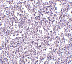 Invitrogen Carabin Polyclonal Antibody 100 &mu;g; Unconjugated:Antibodies