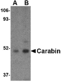 Invitrogen Carabin Polyclonal Antibody 100 &mu;g; Unconjugated:Antibodies