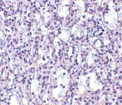 Invitrogen Carabin Polyclonal Antibody 100 &mu;g; Unconjugated:Antibodies,
