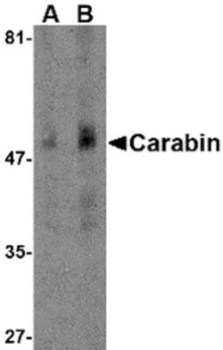 Invitrogen Carabin Polyclonal Antibody 100 &mu;g; Unconjugated:Antibodies,