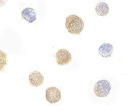 Invitrogen ADAP Polyclonal Antibody 100 &mu;g; Unconjugated:Antibodies,