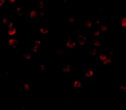 Invitrogen ADAP Polyclonal Antibody 100 &mu;g | Buy Online | Invitrogen&trade; | Fisher Scientific