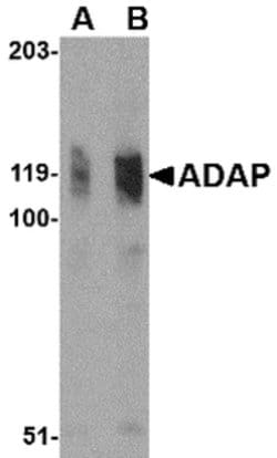 Invitrogen ADAP Polyclonal Antibody 100 &mu;g | Buy Online | Invitrogen&trade; | Fisher Scientific