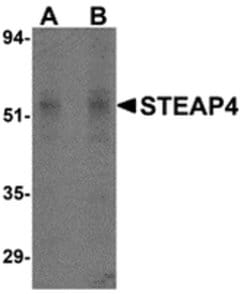 Invitrogen STEAP4 Polyclonal Antibody 100 &mu;g; Unconjugated:Antibodies,